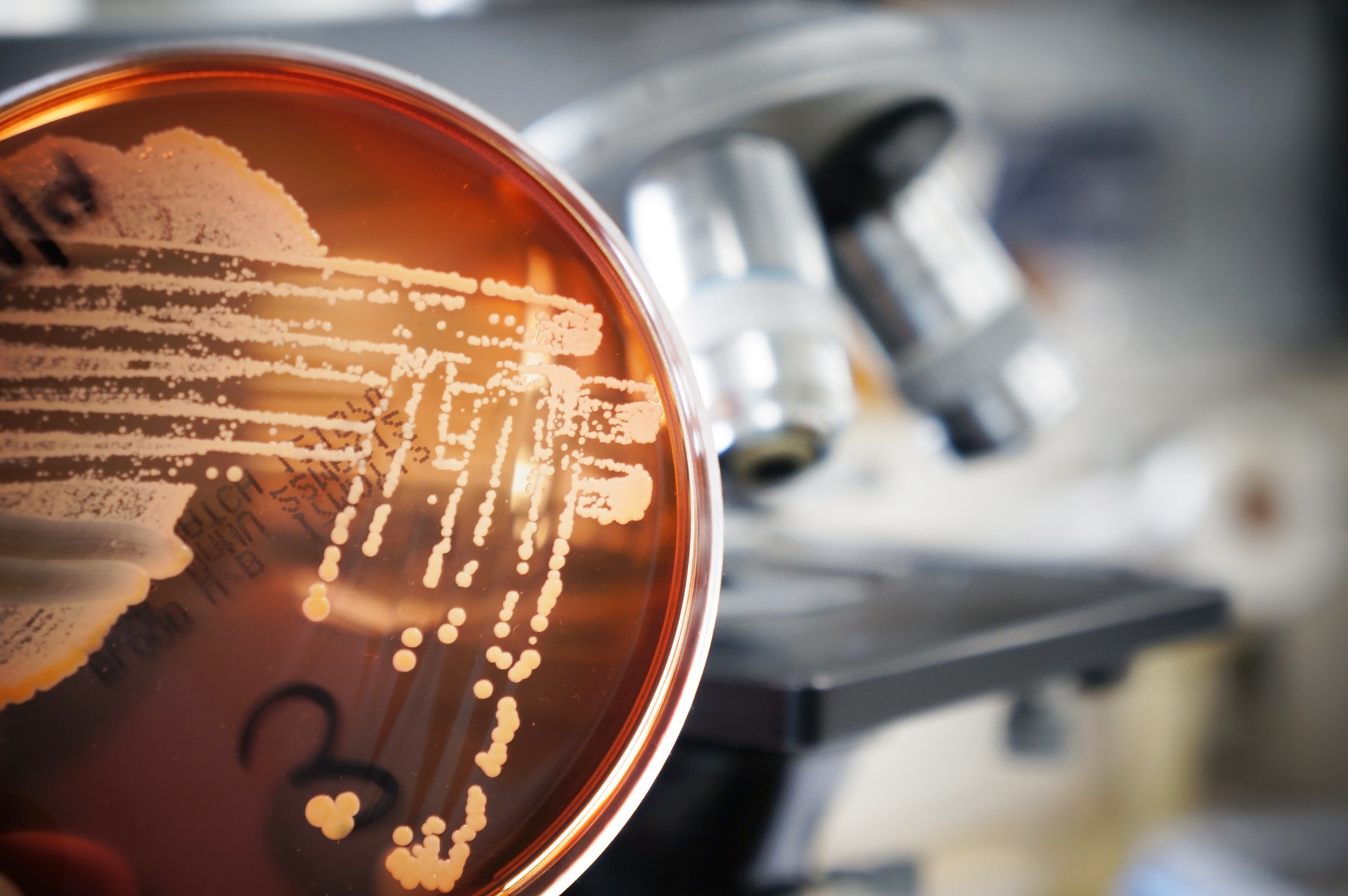 A growth plate with growing microorganism with a microscope background.