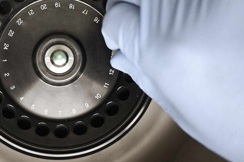 Overhead shot of researcher's hand placing tube in laboratory centrifuge