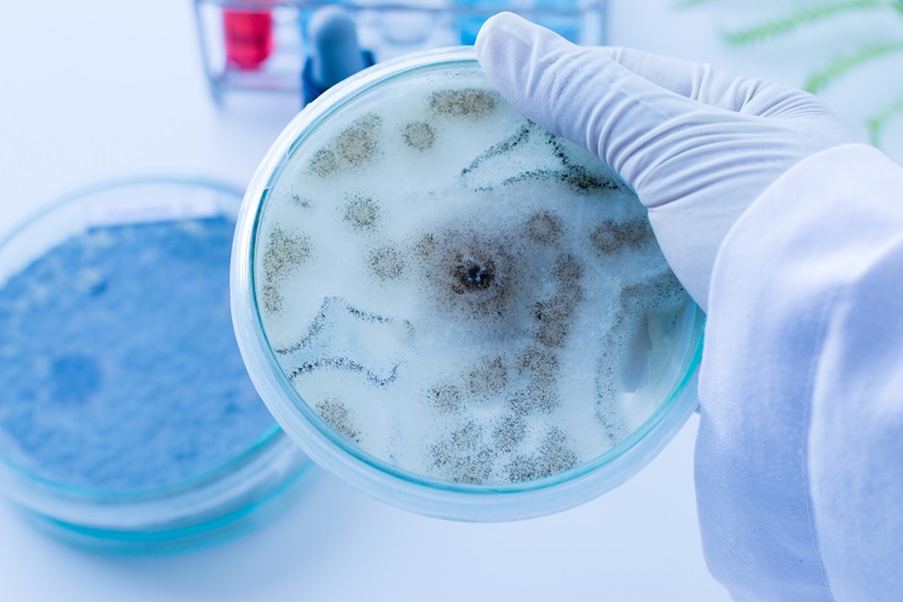 Background of Fungus (Aspergillus) in Petri dishes in laboratories for education in lab.